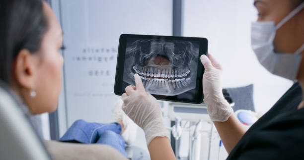 Licensed Teeth Whitening service in Shoreview, MN - Smile Center Dentistry